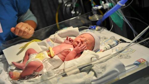 مراحل نمو الاطفال الرضع المبتسرين المولودين قبل ميعادهم