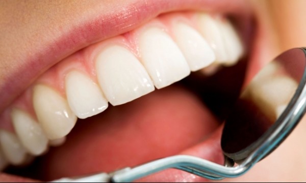 وصفات منزلية تساعدك في علاج تسوس الأسنان  بدون طبيب
