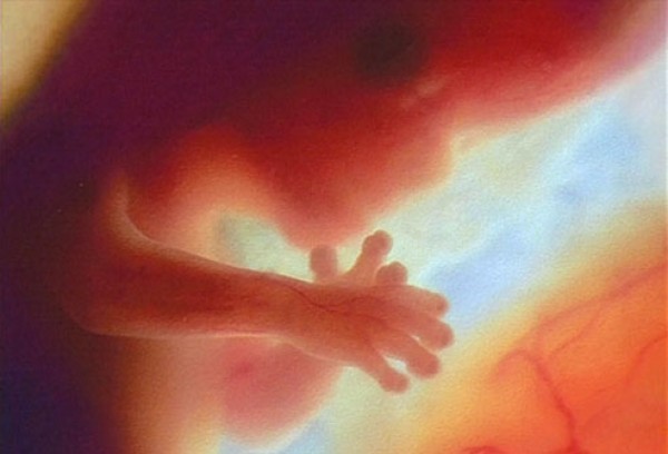 مراحل نمو الجنين بالصور من الحمل إلى الولادة